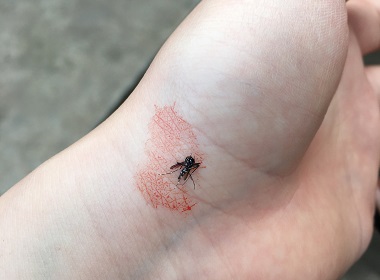 和顺杀虫灭蚊所：夏季用什么方法可以预防蚊虫叮咬